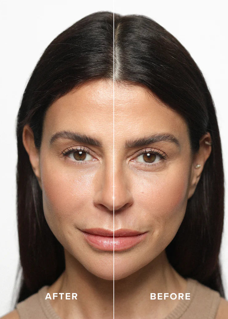 Olcay Gulsen instant eye tightener